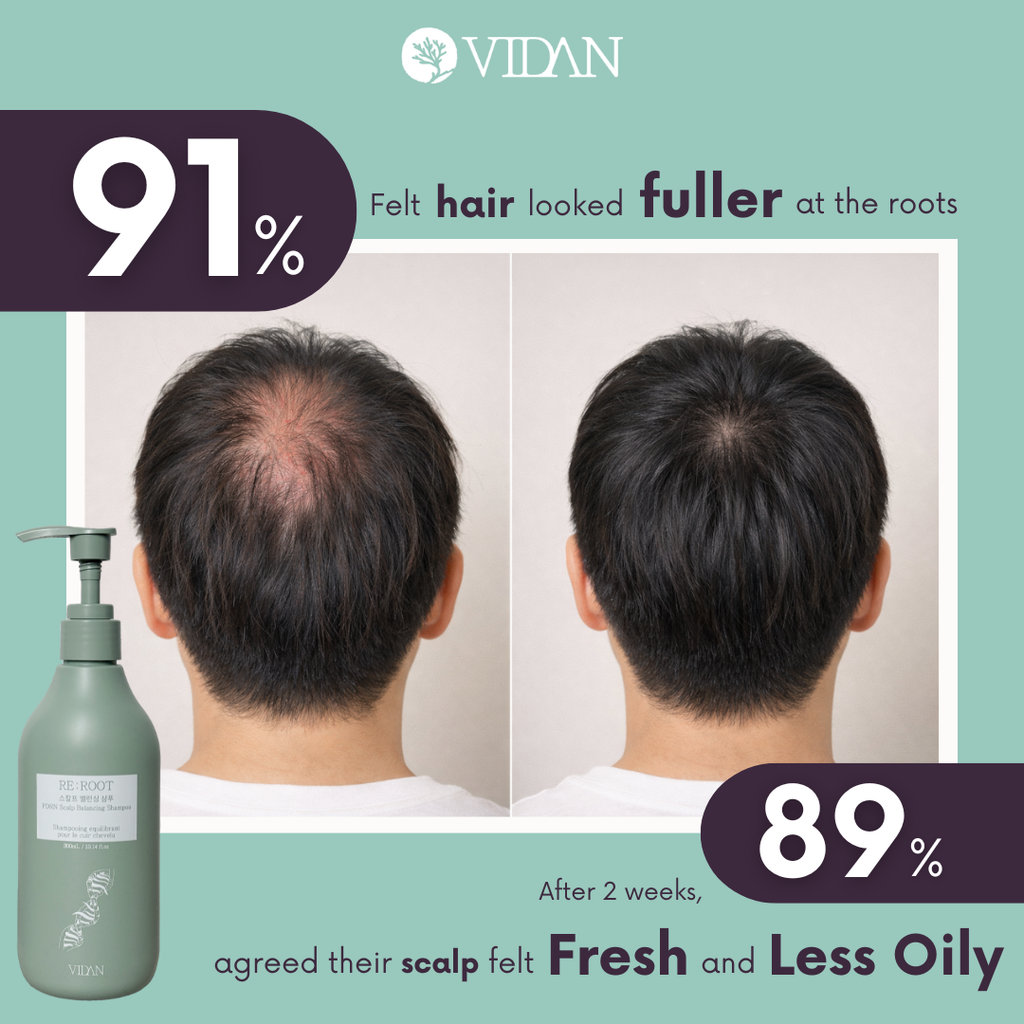 RE:ROOT PDRN Scalp Balancing Shampoo